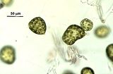 Particolare delle cellule collegate da filamenti non pigmentati